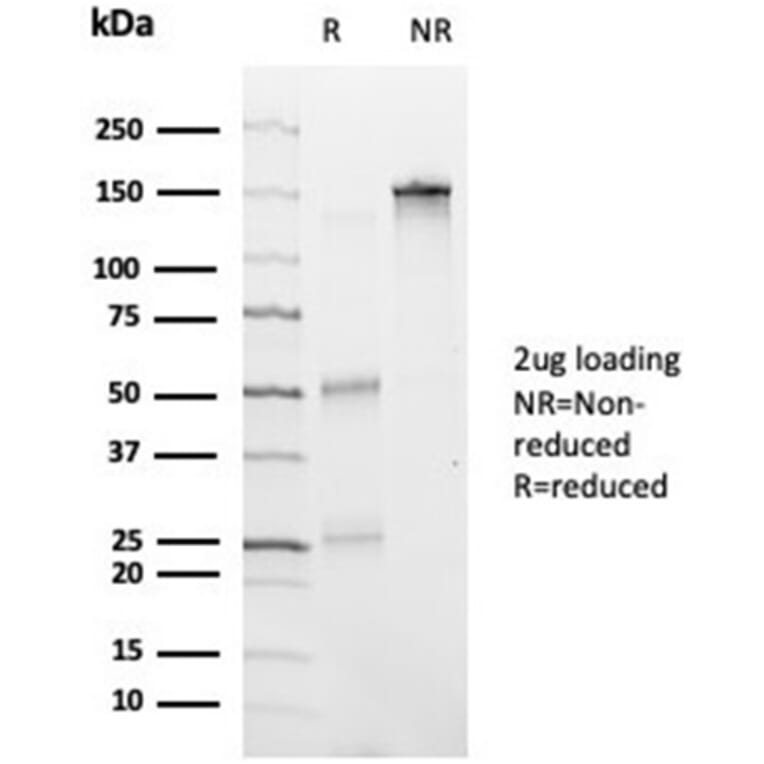 SDS-PAGE - Anti-HDAC6 Antibody [PCRP-HDAC6-1A4] - BSA and Azide free (A278111) - Antibodies.com