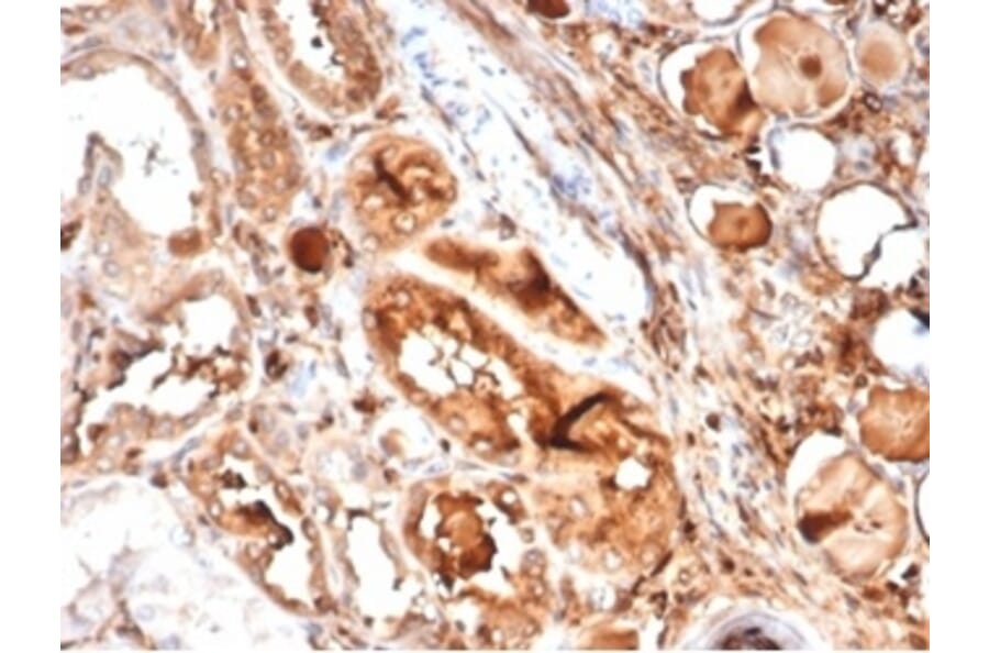 Immunohistochemistry - Anti-MICA Antibody [MICA/4442] - BSA and Azide free (A278114) - Antibodies.com