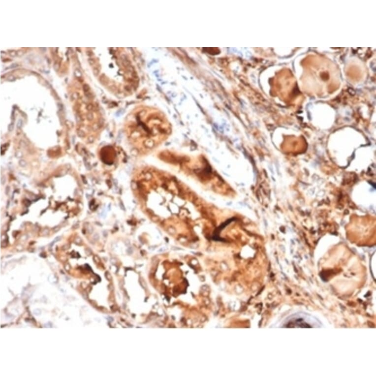 Immunohistochemistry - Anti-MICA Antibody [MICA/4442] - BSA and Azide free (A278114) - Antibodies.com