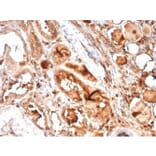 Immunohistochemistry - Anti-MICA Antibody [MICA/4442] - BSA and Azide free (A278114) - Antibodies.com