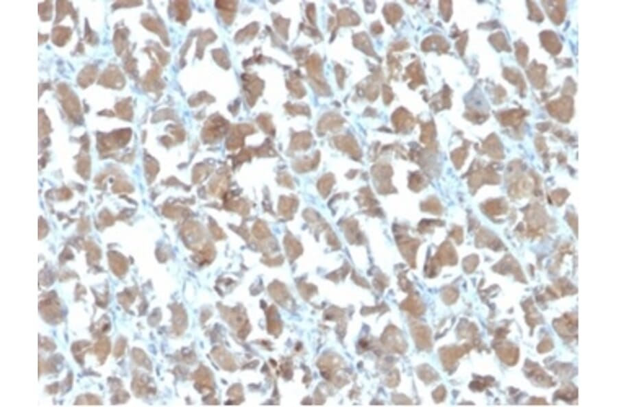 Immunohistochemistry - Anti-MICA Antibody [MICA/4442] - BSA and Azide free (A278114) - Antibodies.com