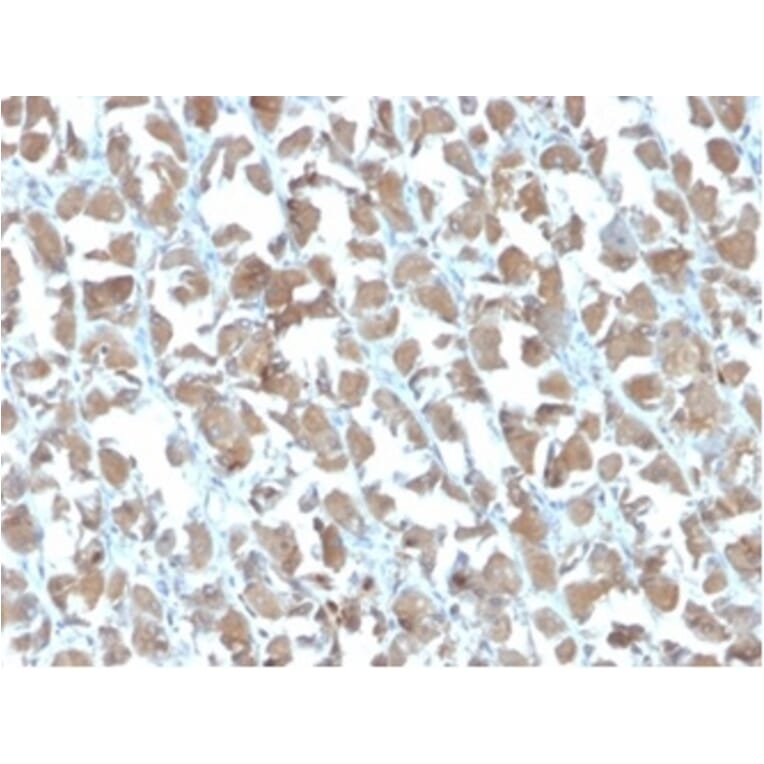 Immunohistochemistry - Anti-MICA Antibody [MICA/4442] - BSA and Azide free (A278114) - Antibodies.com