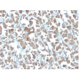 Immunohistochemistry - Anti-MICA Antibody [MICA/4442] - BSA and Azide free (A278114) - Antibodies.com