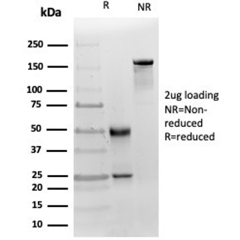 SDS-PAGE - Anti-MICA Antibody [MICA/4442] - BSA and Azide free (A278114) - Antibodies.com