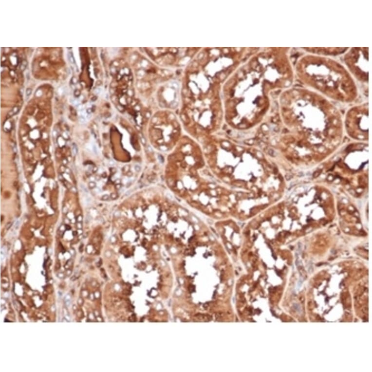 Immunohistochemistry - Anti-MICA Antibody [MICA/4443] - BSA and Azide free (A278115) - Antibodies.com