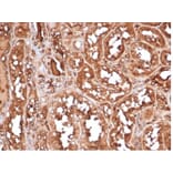 Immunohistochemistry - Anti-MICA Antibody [MICA/4443] - BSA and Azide free (A278115) - Antibodies.com