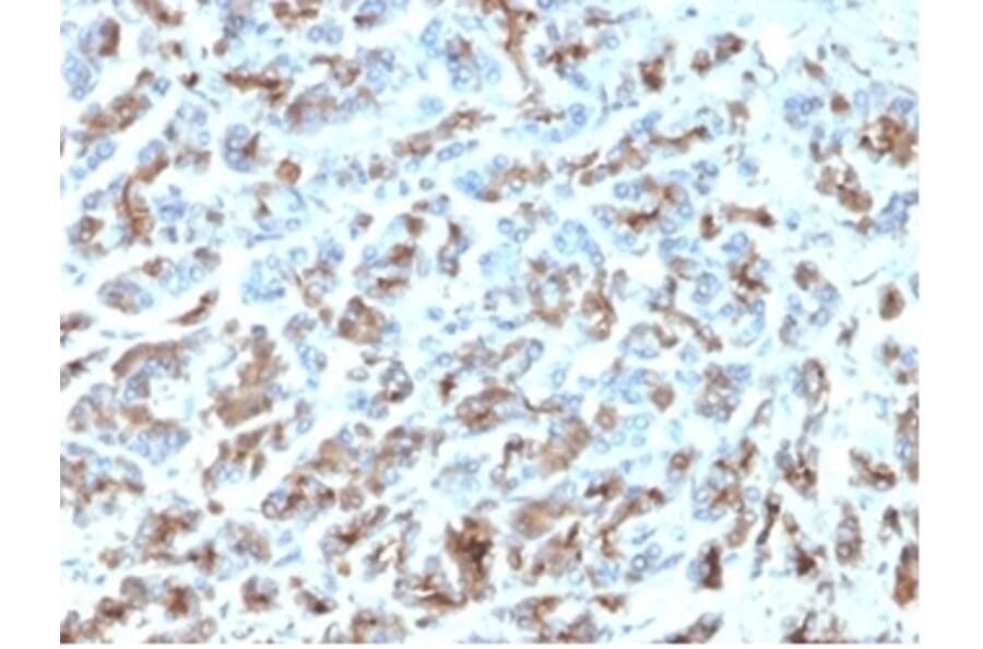 Immunohistochemistry - Anti-MICA Antibody [MICA/4443] - BSA and Azide free (A278115) - Antibodies.com