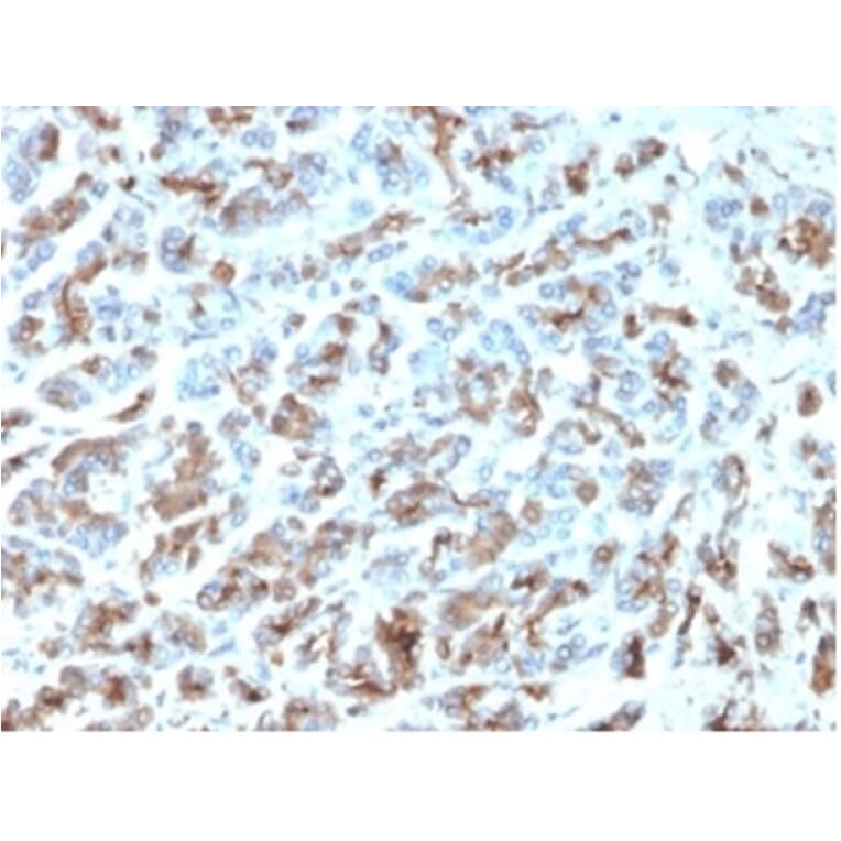 Immunohistochemistry - Anti-MICA Antibody [MICA/4443] - BSA and Azide free (A278115) - Antibodies.com