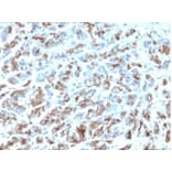 Immunohistochemistry - Anti-MICA Antibody [MICA/4443] - BSA and Azide free (A278115) - Antibodies.com