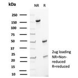 SDS-PAGE - Anti-p27 Kip1 Antibody [KIP1/1357] - BSA and Azide free (A278116) - Antibodies.com