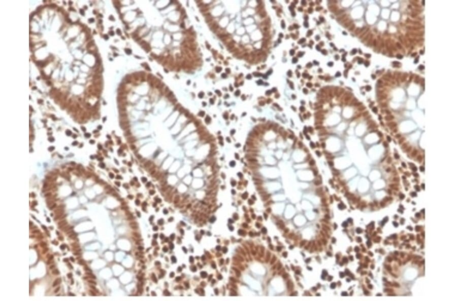 Immunohistochemistry - Anti-p27 Kip1 Antibody [KIP1/1357] - BSA and Azide free (A278116) - Antibodies.com