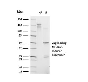 SDS-PAGE - Anti-IRF9 Antibody [PCRP-IRF9-2F8] - BSA and Azide free (A278117) - Antibodies.com