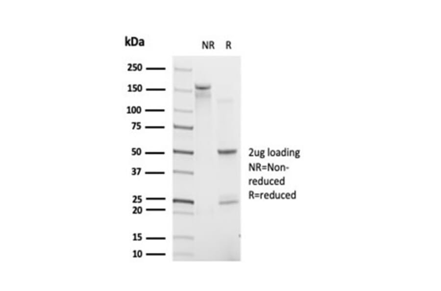 SDS-PAGE - Anti-IRF9 Antibody [PCRP-IRF9-2F8] - BSA and Azide free (A278117) - Antibodies.com