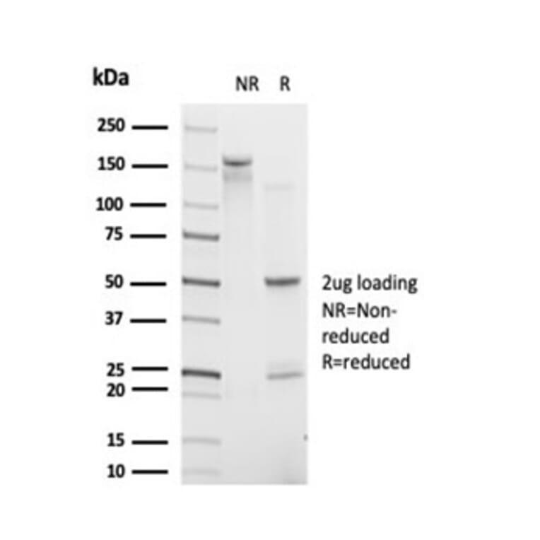 SDS-PAGE - Anti-IRF9 Antibody [PCRP-IRF9-2F8] - BSA and Azide free (A278117) - Antibodies.com