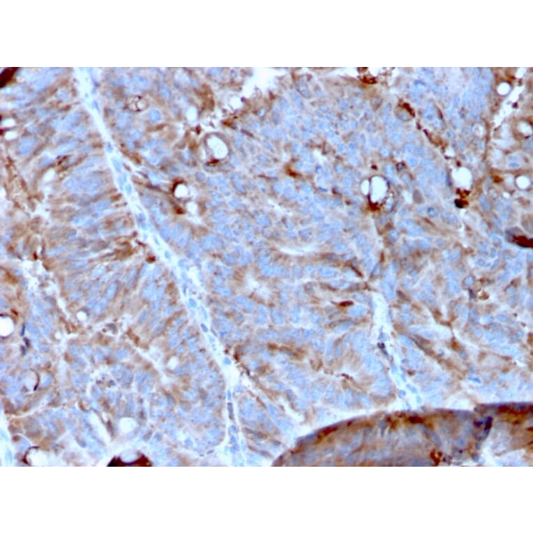 Immunohistochemistry - Anti-MerTK Antibody [MERTK/3023] - BSA and Azide free (A278118) - Antibodies.com