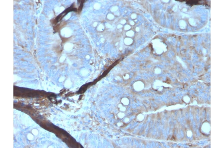 Immunohistochemistry - Anti-MerTK Antibody [MERTK/3023] - BSA and Azide free (A278118) - Antibodies.com