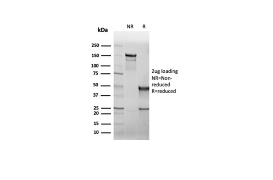 SDS-PAGE - Anti-CFTR Antibody [rCFTR/6476] - BSA and Azide free (A278122) - Antibodies.com