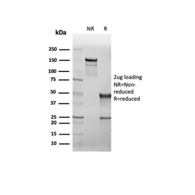 SDS-PAGE - Anti-CFTR Antibody [rCFTR/6476] - BSA and Azide free (A278122) - Antibodies.com