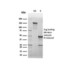 SDS-PAGE - Anti-CFTR Antibody [rCFTR/6476] - BSA and Azide free (A278122) - Antibodies.com