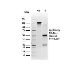 SDS-PAGE - Anti-FTCD Antibody [FTCD/357] - BSA and Azide free (A278123) - Antibodies.com