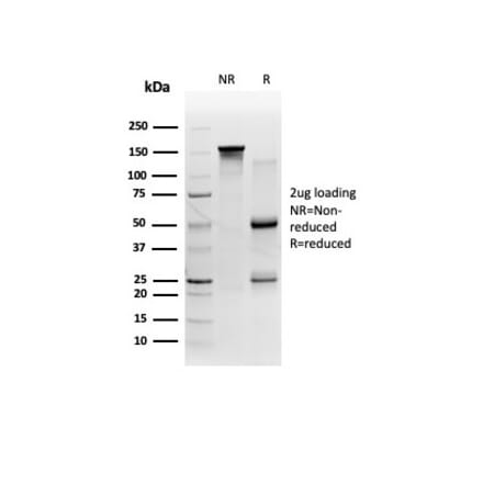 SDS-PAGE - Anti-FTCD Antibody [FTCD/357] - BSA and Azide free (A278123) - Antibodies.com