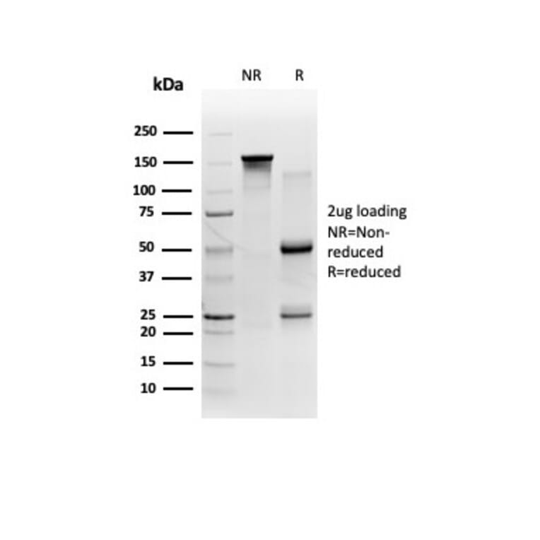 SDS-PAGE - Anti-FTCD Antibody [FTCD/357] - BSA and Azide free (A278123) - Antibodies.com