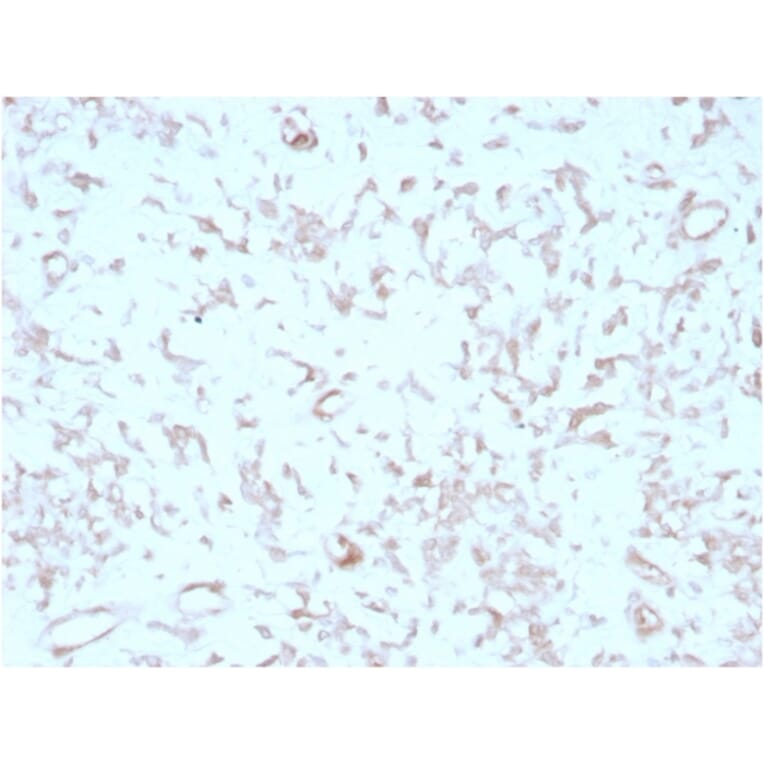 Immunohistochemistry - Anti-Kindlin 2 Antibody [3A3] - BSA and Azide free (A278124) - Antibodies.com