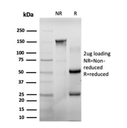 SDS-PAGE - Anti-CHEK2 Antibody [PCRP-CHEK2-1A4] - BSA and Azide free (A278128) - Antibodies.com