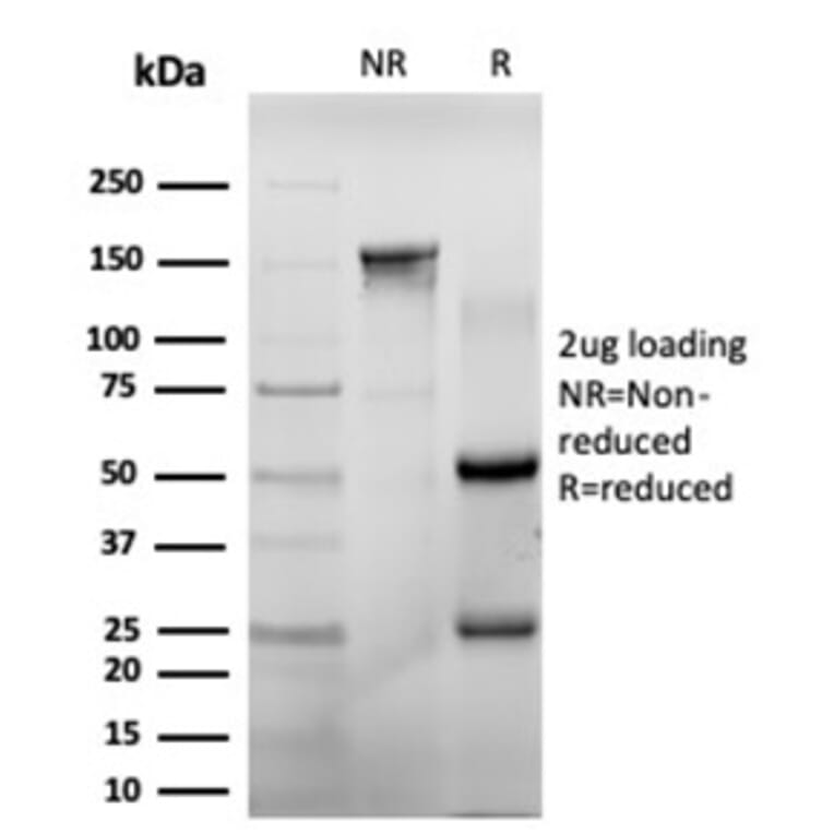 SDS-PAGE - Anti-CHEK2 Antibody [PCRP-CHEK2-1A4] - BSA and Azide free (A278128) - Antibodies.com