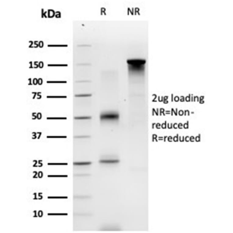 SDS-PAGE - Anti-ECD Antibody [PCRP-ECD-1D10] - BSA and Azide free (A278130) - Antibodies.com