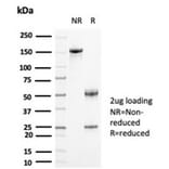 SDS-PAGE - Anti-Creatine Kinase BB Antibody [CKBB/6871] - BSA and Azide free (A278131) - Antibodies.com