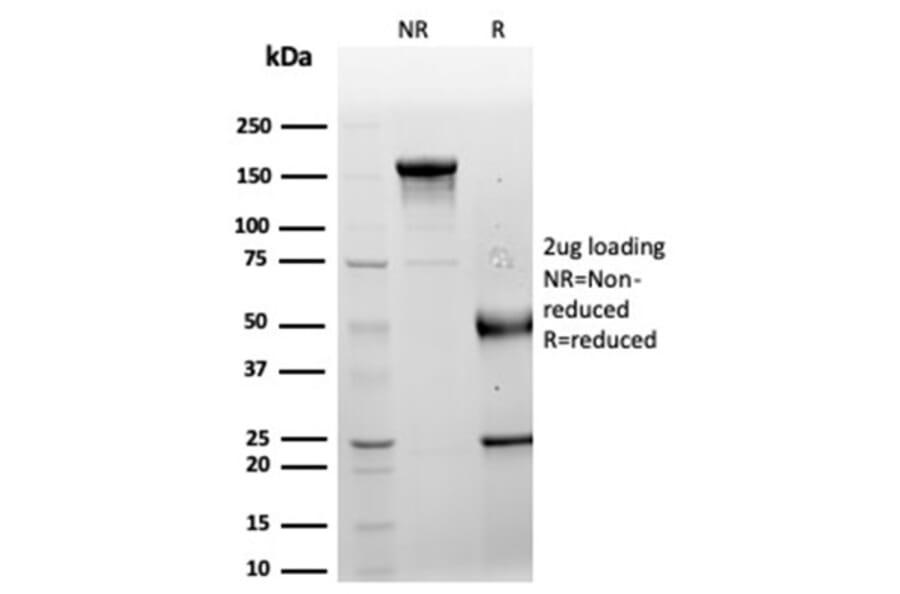 SDS-PAGE - Anti-LRG1 Antibody [LRG1/4882] - BSA and Azide free (A278132) - Antibodies.com
