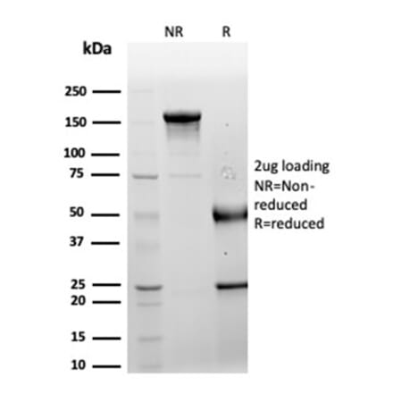 SDS-PAGE - Anti-LRG1 Antibody [LRG1/4882] - BSA and Azide free (A278132) - Antibodies.com