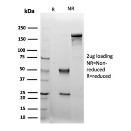 SDS-PAGE - Anti-LRG1 Antibody [LRG1/4883] - BSA and Azide free (A278133) - Antibodies.com