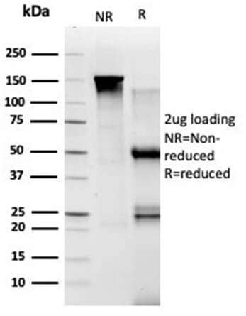 SDS-PAGE analysis of Anti-TADA1 Antibody [PCRP-TADA1-1C9] under non-reduced and reduced conditions; showing intact IgG and intact heavy and light chains, respectively. SDS-PAGE analysis confirms the integrity and purity of the antibody.