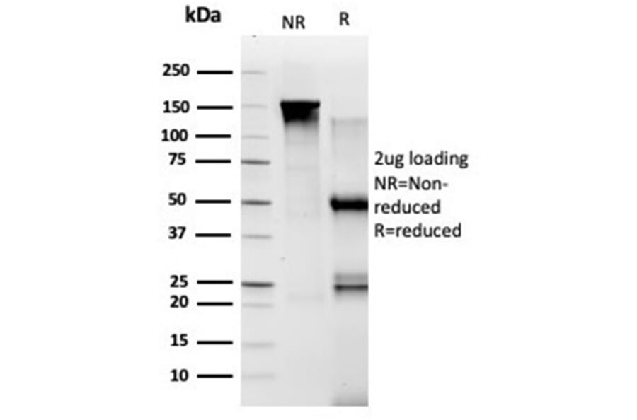 SDS-PAGE - Anti-TADA1 Antibody [PCRP-TADA1-1C9] - BSA and Azide free (A278134) - Antibodies.com