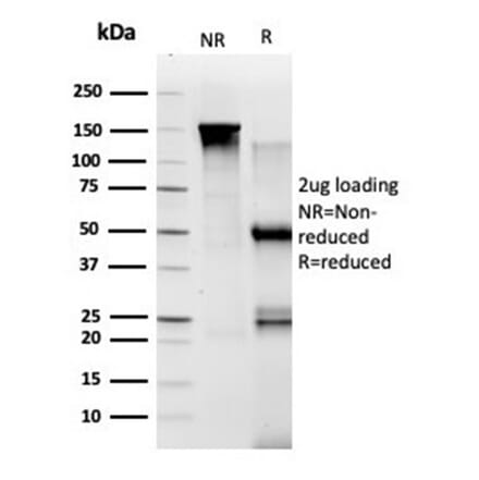 SDS-PAGE - Anti-TADA1 Antibody [PCRP-TADA1-1C9] - BSA and Azide free (A278134) - Antibodies.com