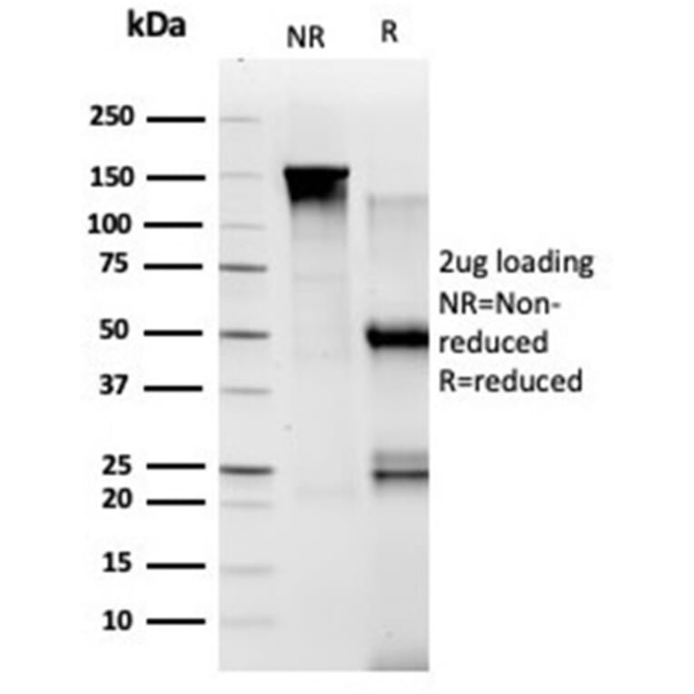 SDS-PAGE - Anti-TADA1 Antibody [PCRP-TADA1-1C9] - BSA and Azide free (A278134) - Antibodies.com