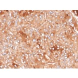 Immunohistochemistry - Anti-Clusterin Antibody [CLU/4730] - BSA and Azide free (A278135) - Antibodies.com