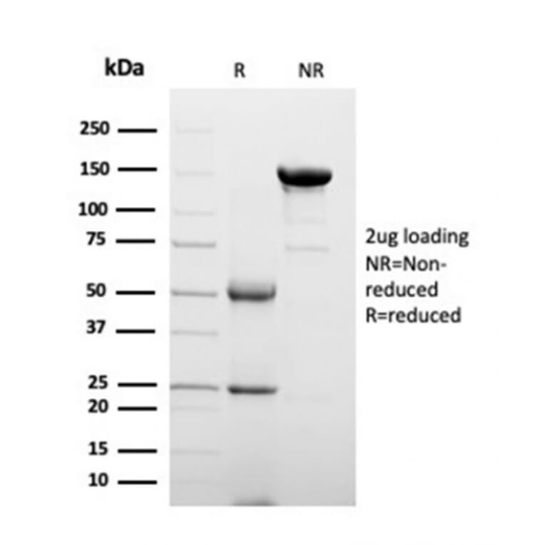 SDS-PAGE - Anti-Clusterin Antibody [CLU/4723] - BSA and Azide free (A278138) - Antibodies.com