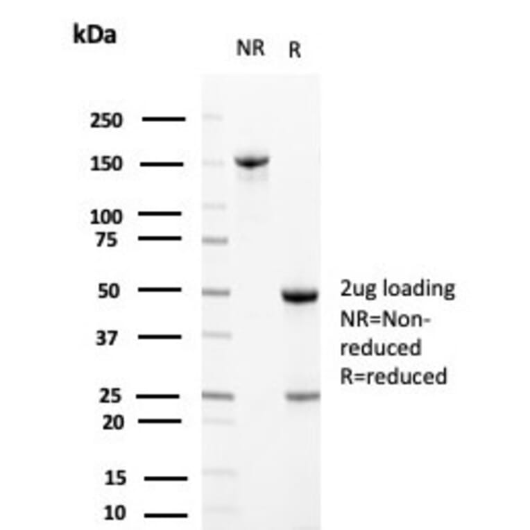 SDS-PAGE - Anti-Clusterin Antibody [CLU/4729] - BSA and Azide free (A278140) - Antibodies.com