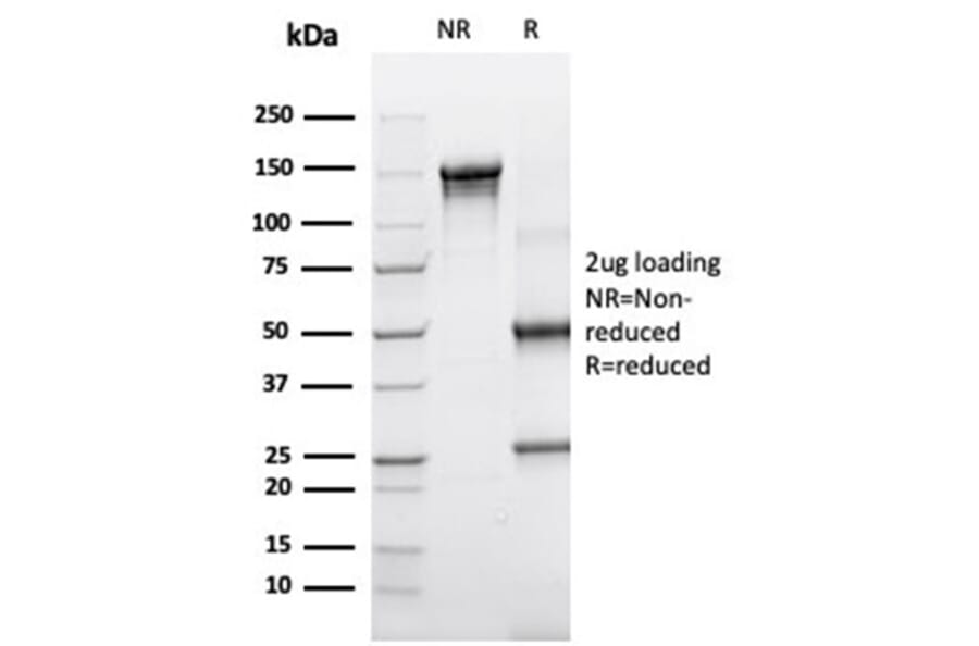 SDS-PAGE - Anti-alpha 1 Antichymotrypsin Antibody [SERPINA3/4190] - BSA and Azide free (A278141) - Antibodies.com