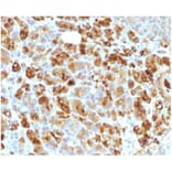Immunohistochemistry - Anti-alpha 1 Antichymotrypsin Antibody [AACT/1451 + AACT/1452] - BSA and Azide free (A278142) - Antibodies.com