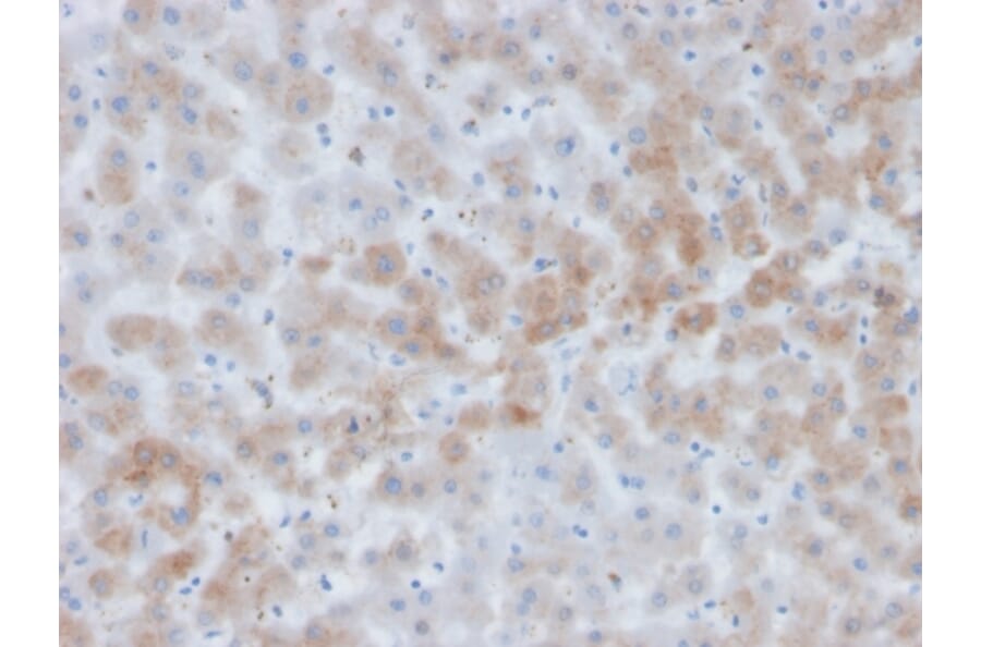 Immunohistochemistry - Anti-alpha 1 Antichymotrypsin Antibody [SERPINA3/4184] - BSA and Azide free (A278143) - Antibodies.com
