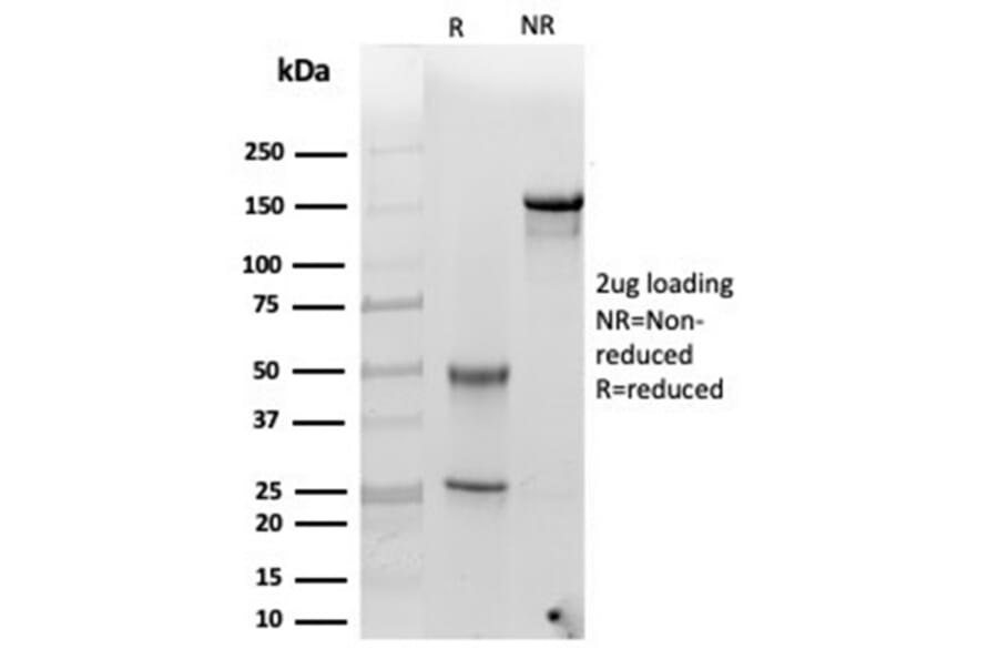 SDS-PAGE - Anti-alpha 1 Antichymotrypsin Antibody [SERPINA3/4185] - BSA and Azide free (A278144) - Antibodies.com