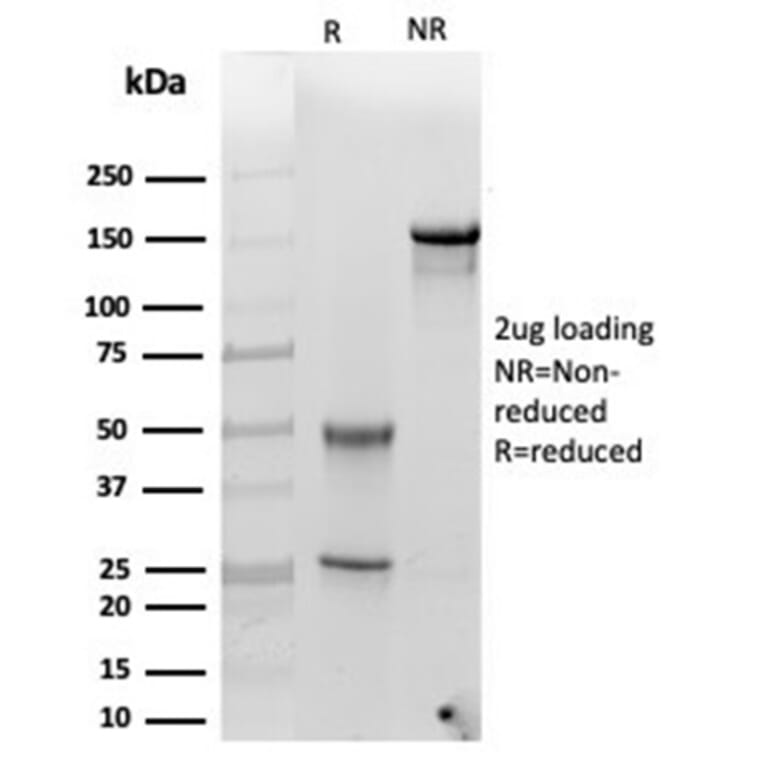SDS-PAGE - Anti-alpha 1 Antichymotrypsin Antibody [SERPINA3/4185] - BSA and Azide free (A278144) - Antibodies.com
