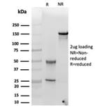 SDS-PAGE - Anti-alpha 1 Antichymotrypsin Antibody [SERPINA3/4185] - BSA and Azide free (A278144) - Antibodies.com