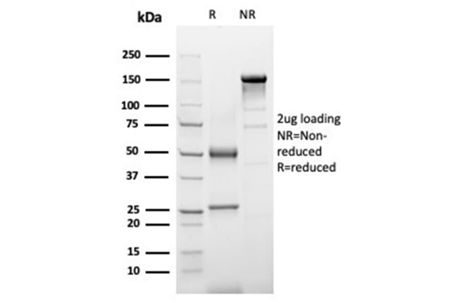 SDS-PAGE - Anti-alpha 1 Antichymotrypsin Antibody [SERPINA3/4187] - BSA and Azide free (A278145) - Antibodies.com