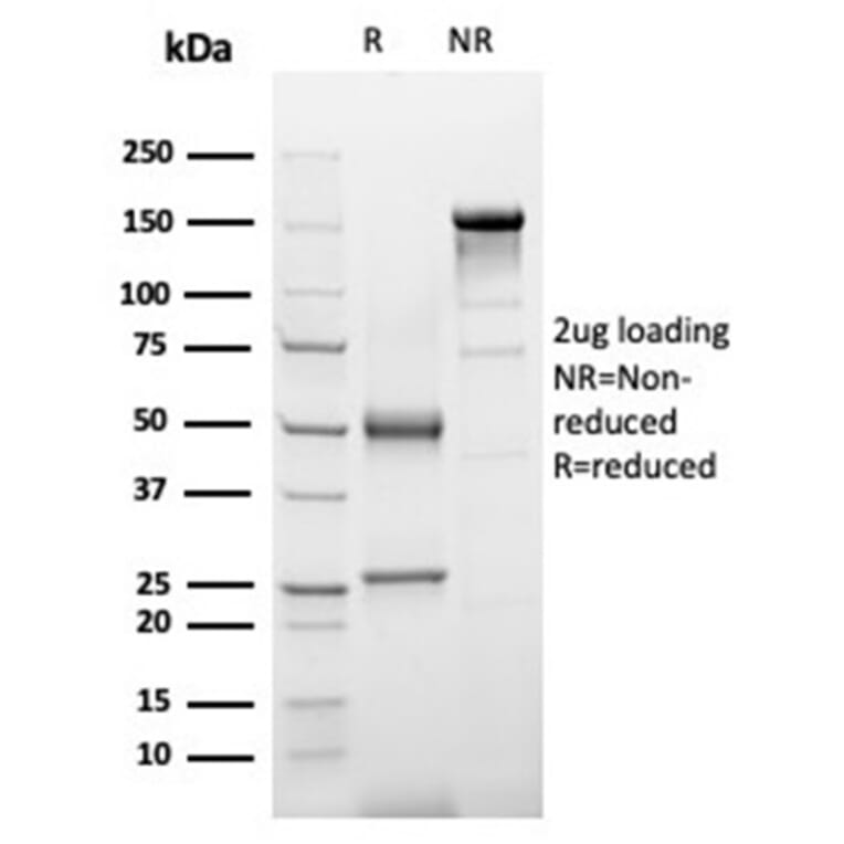 SDS-PAGE - Anti-alpha 1 Antichymotrypsin Antibody [SERPINA3/4187] - BSA and Azide free (A278145) - Antibodies.com