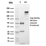 SDS-PAGE - Anti-alpha 1 Antichymotrypsin Antibody [SERPINA3/4187] - BSA and Azide free (A278145) - Antibodies.com